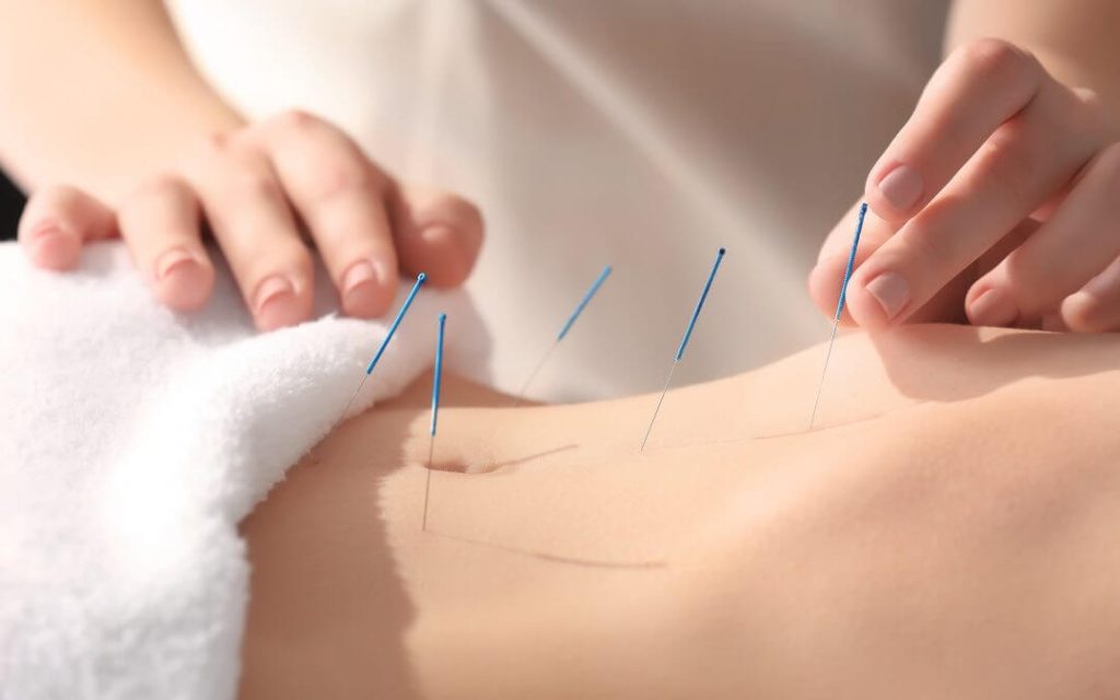Can Acupuncture Help With Weight Loss?