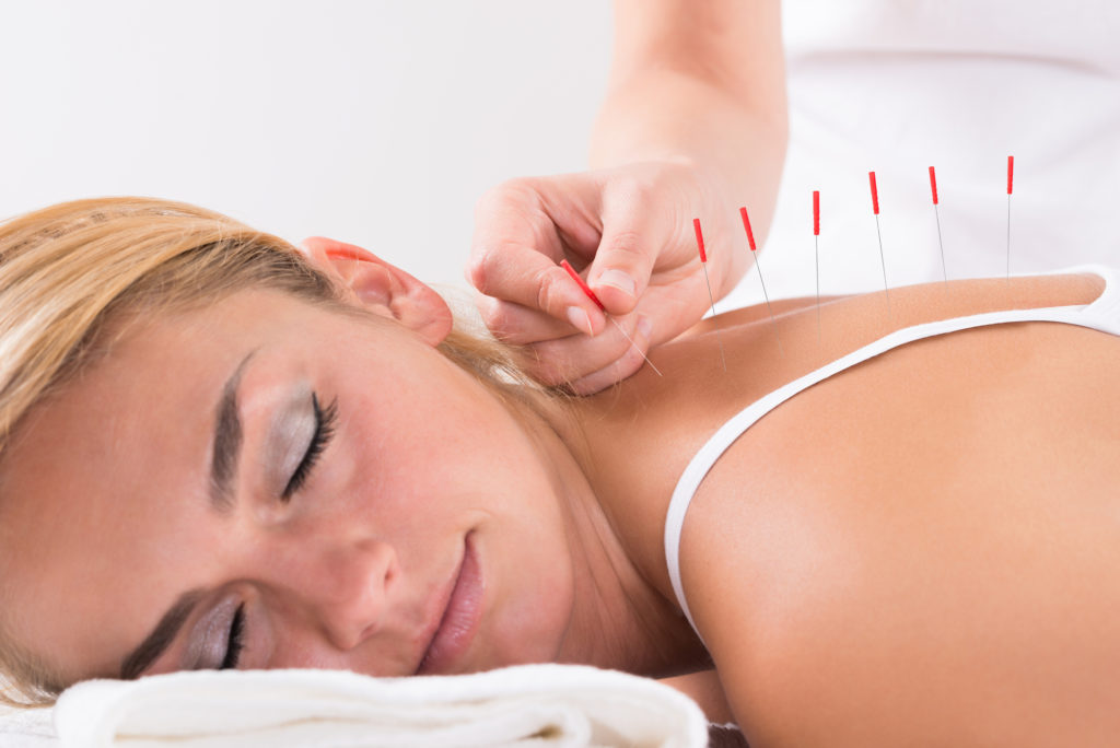 What Is Acupuncture Good For