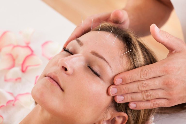 Acupuncture Largo FL
